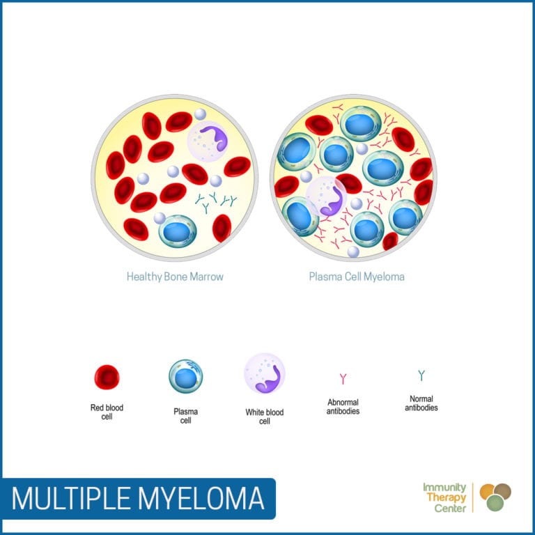 Treat Multiple Myeloma Naturally | Immunity Therapy Center - Tijuana ...